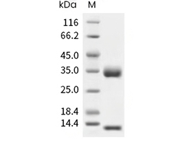 FCGRT & B2M Heterodimer Protein, Human, Recombinant (His)
