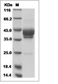 MSLN/Mesothelin Protein, Human, Recombinant