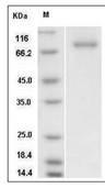 Src Protein, Human, Recombinant (His & GST)