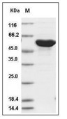 Influenza A H2N2 (A/Ann Arbor/6/1960) Nucleoprotein/NP Protein (His)