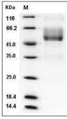 Mucin-1/MUC1 Protein, Human, Recombinant (Isoform Y-LSP, hFc)