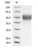 CD122/IL2RB Protein, Mouse, Recombinant (His)