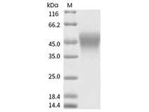 CD16b Protein, Human, Recombinant (NA2, HEK293, His)