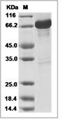 GAD2/GAD65 Protein, Human, Recombinant (GST)