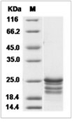 FGF-16 Protein, Human/Cynomolgus, Recombinant