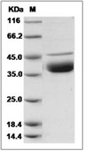 DNase I Protein, Human, Recombinant (His)