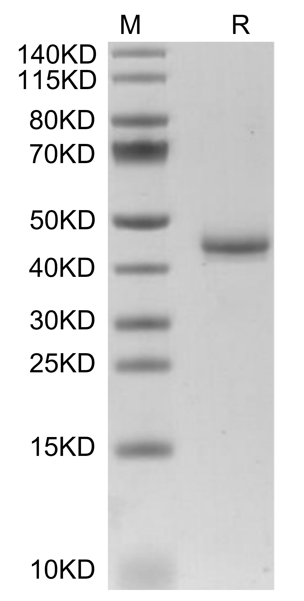 Procalcitonin/CALCA Protein, Mouse, Recombinant (hFc)