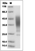 ORM2 Protein, Human, Recombinant (His)