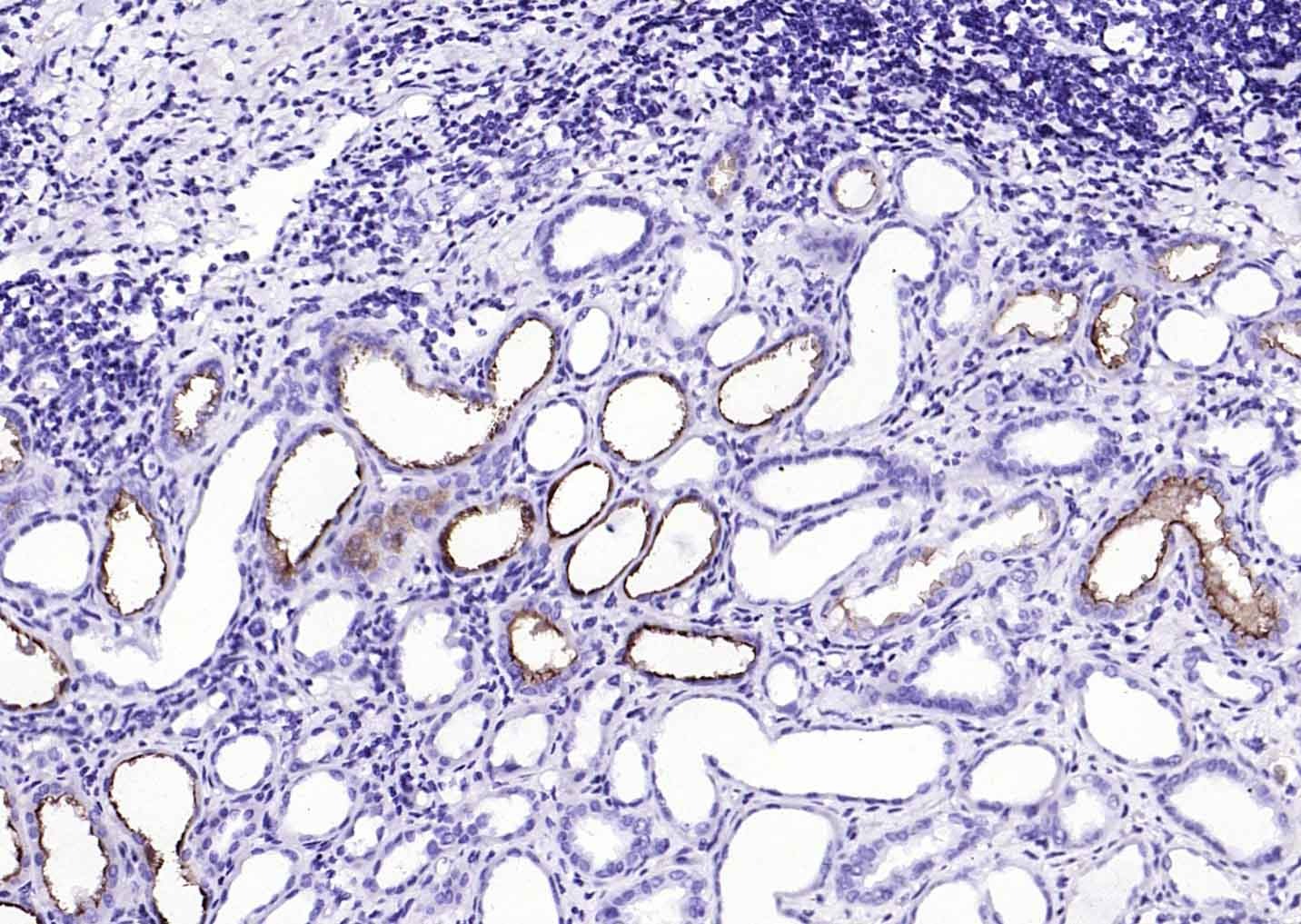 F(ab')₂ Fragment Goat Anti-Rabbit IgG H&L Secondary Antibody-HRP