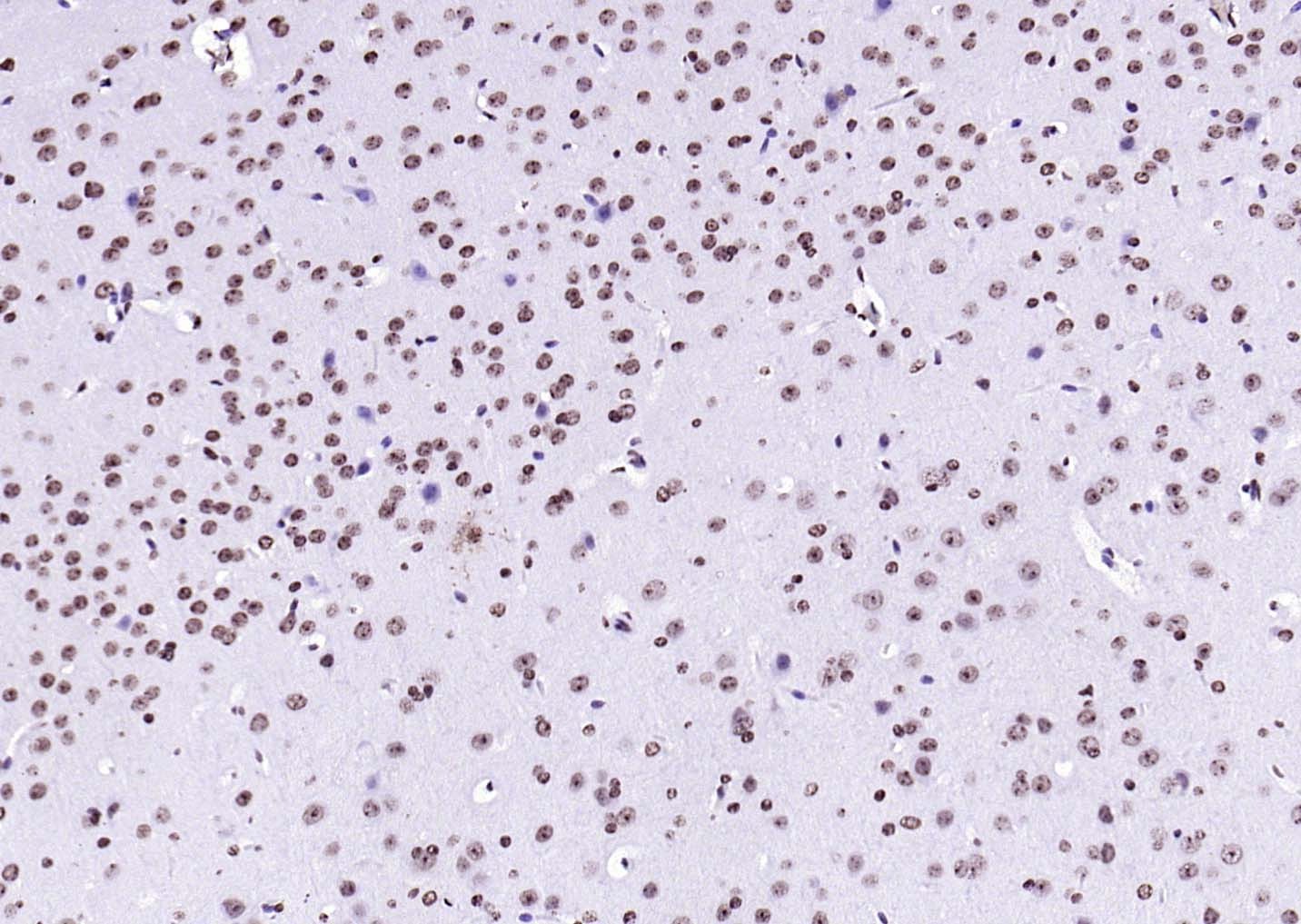 F(ab')₂ Fragment Goat Anti-Rabbit IgG H&L Secondary Antibody-HRP