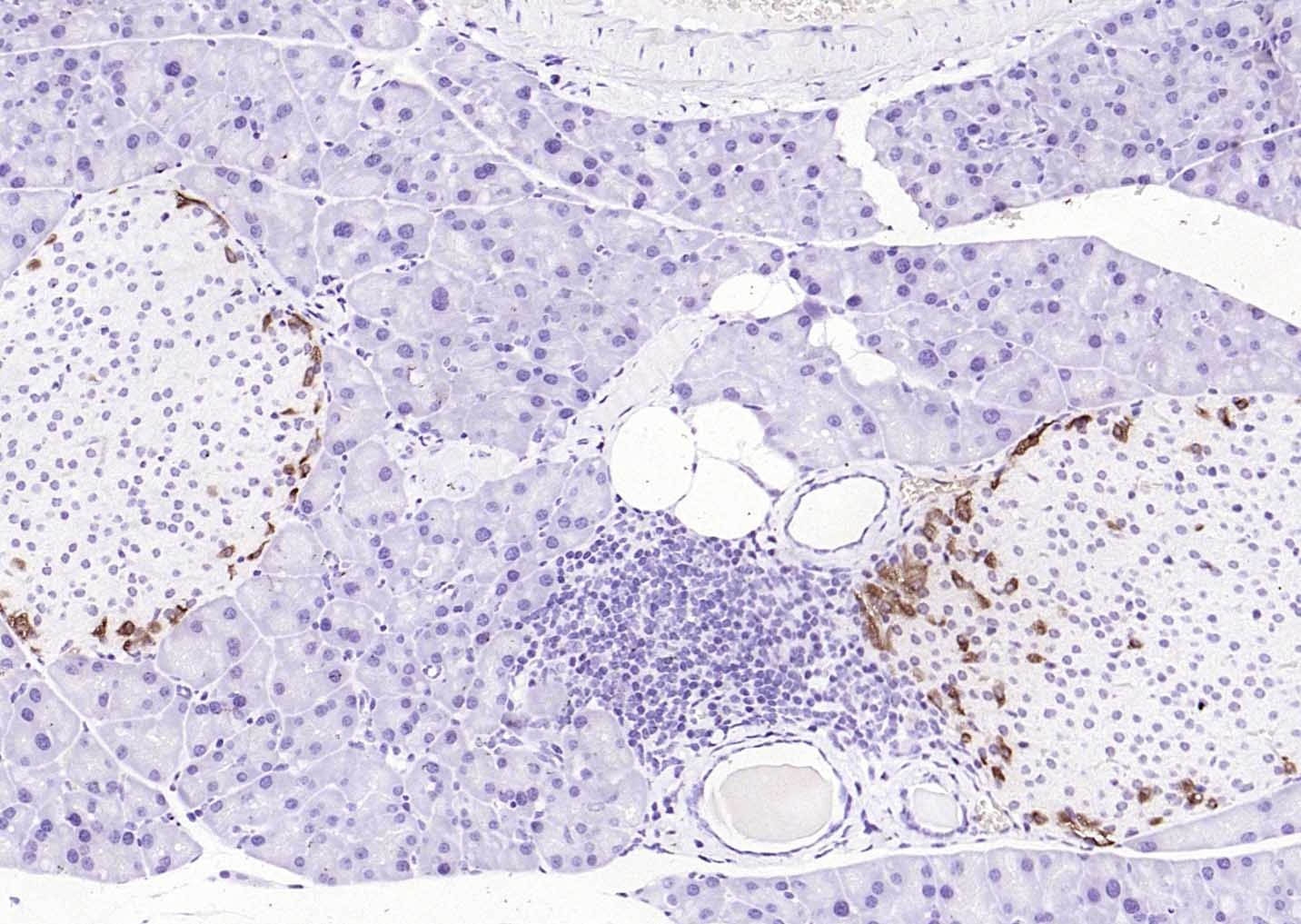 F(ab')₂ Fragment Goat Anti-Rabbit IgG H&L Secondary Antibody-HRP