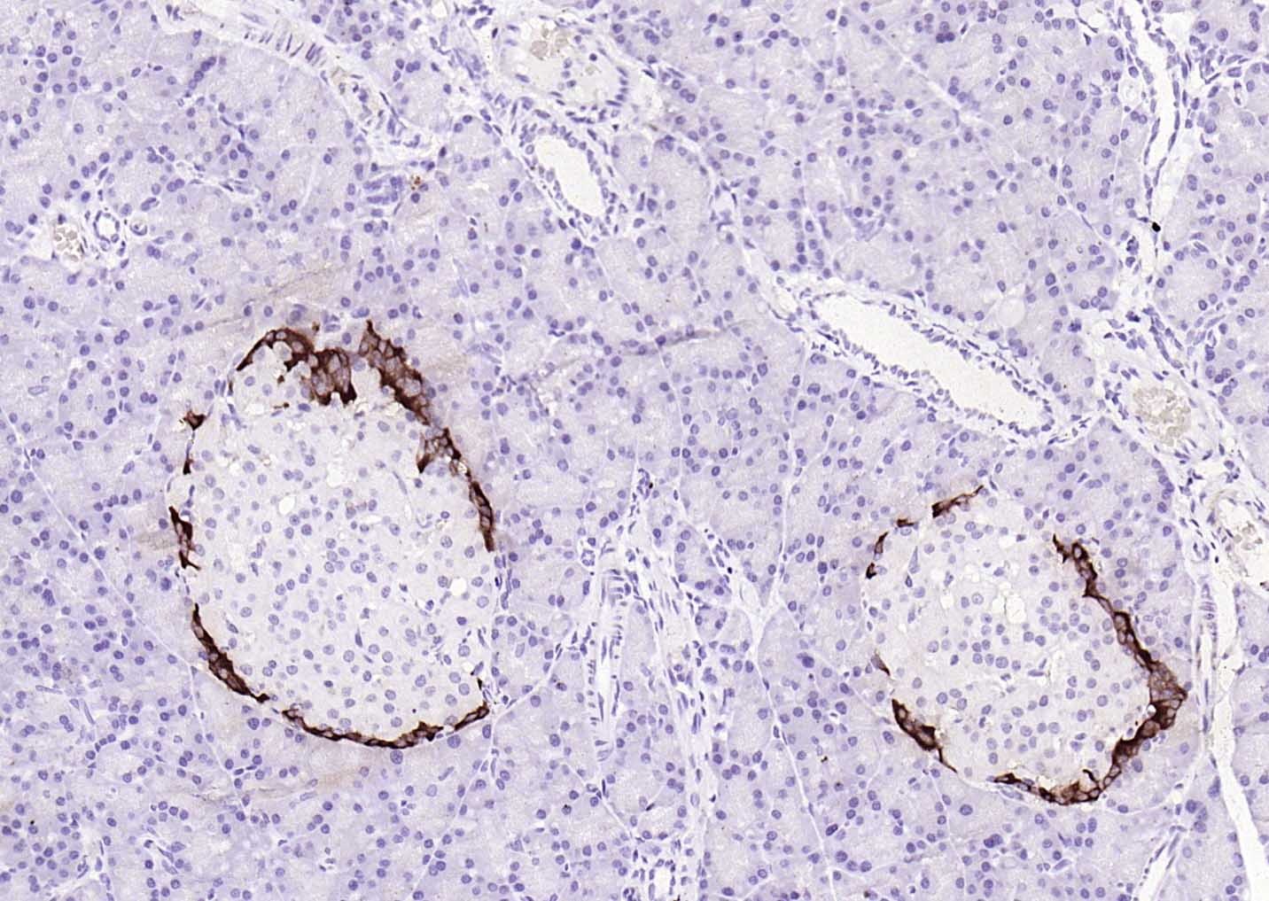 F(ab')₂ Fragment Goat Anti-Rabbit IgG H&L Secondary Antibody-HRP