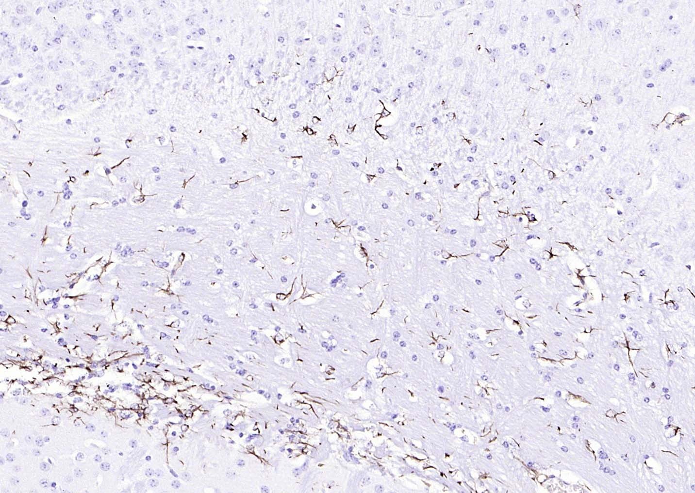 F(ab')₂ Fragment Goat Anti-Rabbit IgG H&L Secondary Antibody-HRP