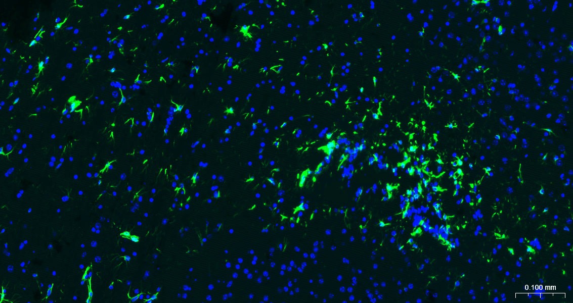 F(ab')₂ Fragment Goat Anti-rabbit IgG H&L Secondary Antibody-FITC
