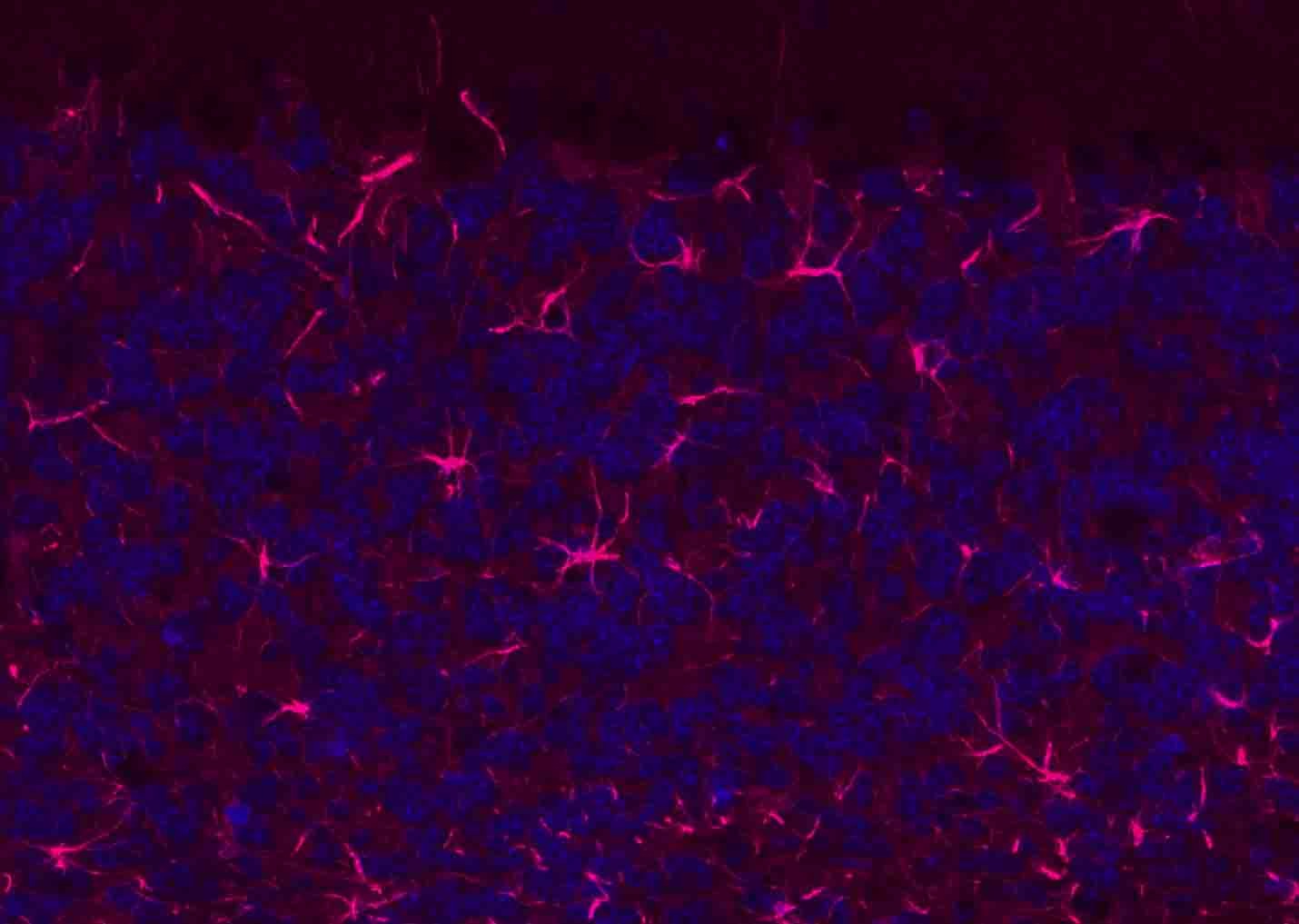 Donkey Anti-Rabbit IgG H&L Secondary Antibody-AF594