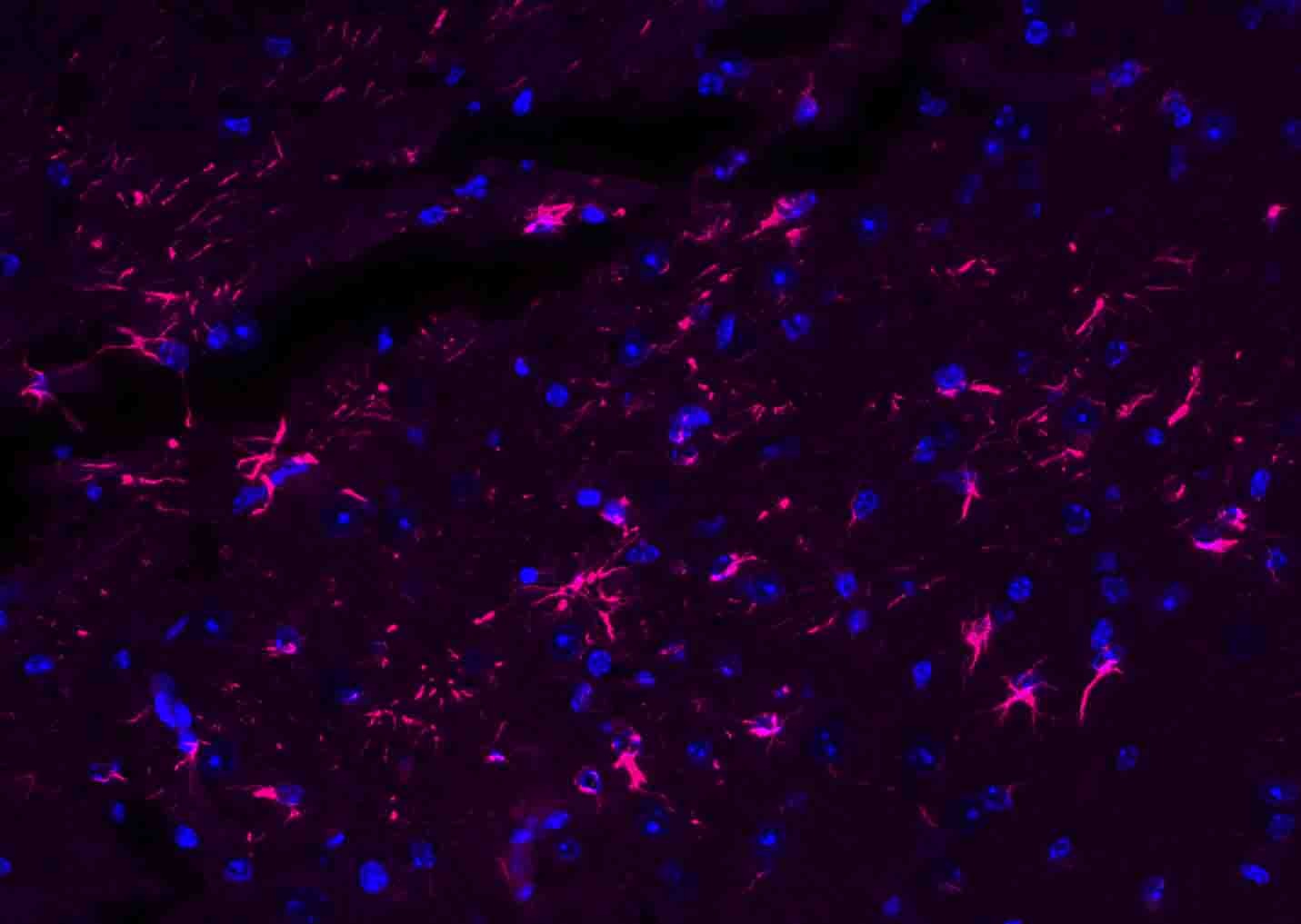 Donkey Anti-Rabbit IgG H&L Secondary Antibody-AF594