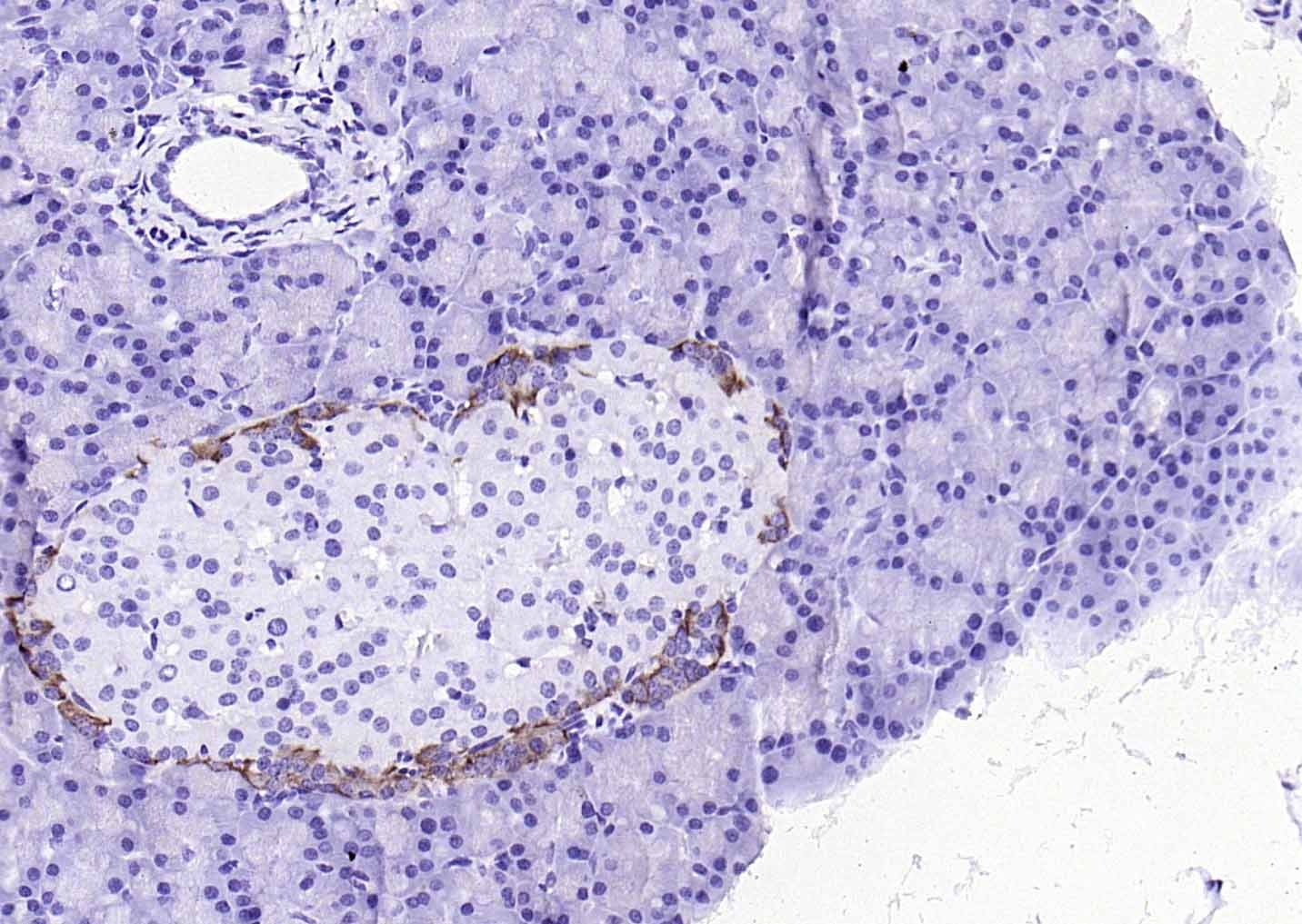 F(ab')₂ Fragment Goat Anti-Mouse IgG H&L Secondary Antibody-HRP