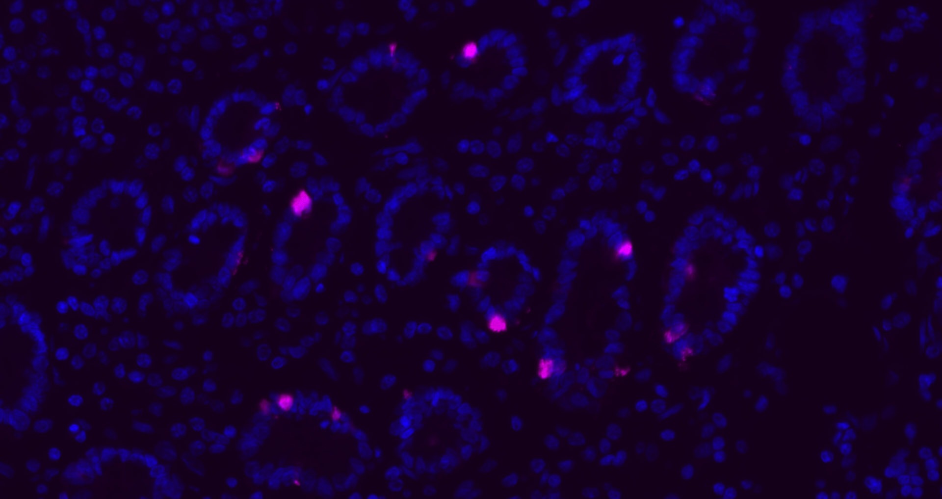 Donkey Anti-Rabbit IgG H&L Secondary Antibody-Cy5