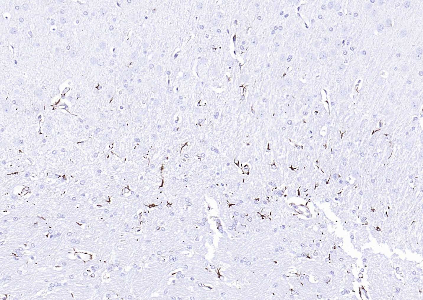 F(ab')₂ Fragment Goat Anti-Rabbit IgG H&L Secondary Antibody-HRP