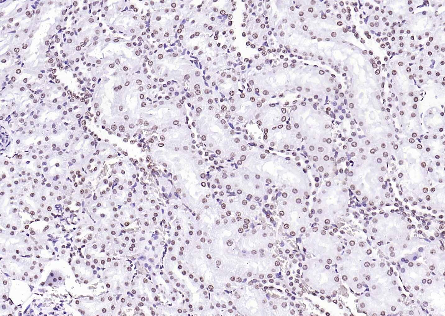 F(ab')₂ Fragment Goat Anti-Rabbit IgG H&L Secondary Antibody-HRP