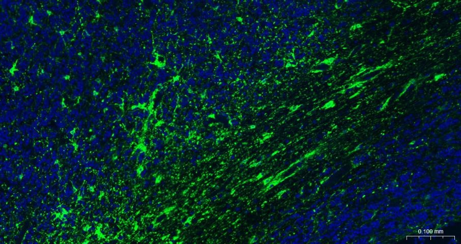 F(ab')₂ Fragment Goat Anti-rabbit IgG H&L Secondary Antibody-FITC