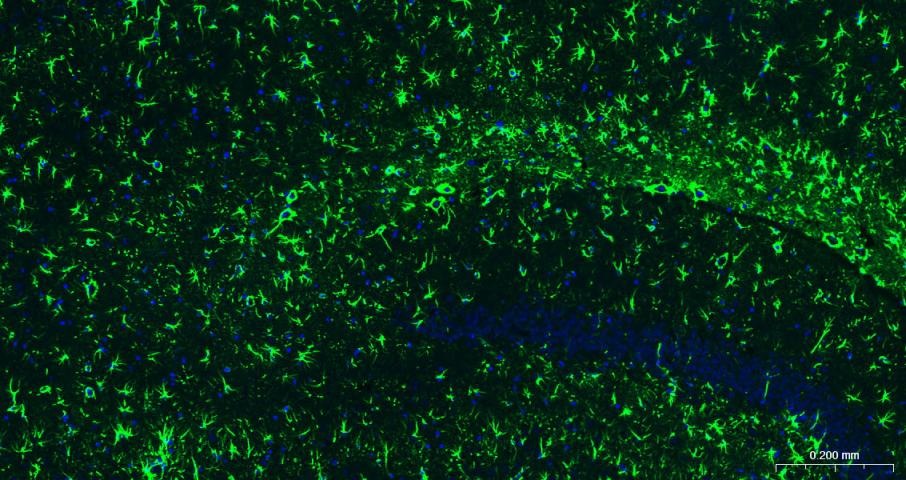 F(ab')₂ Fragment Goat Anti-rabbit IgG H&L Secondary Antibody-FITC