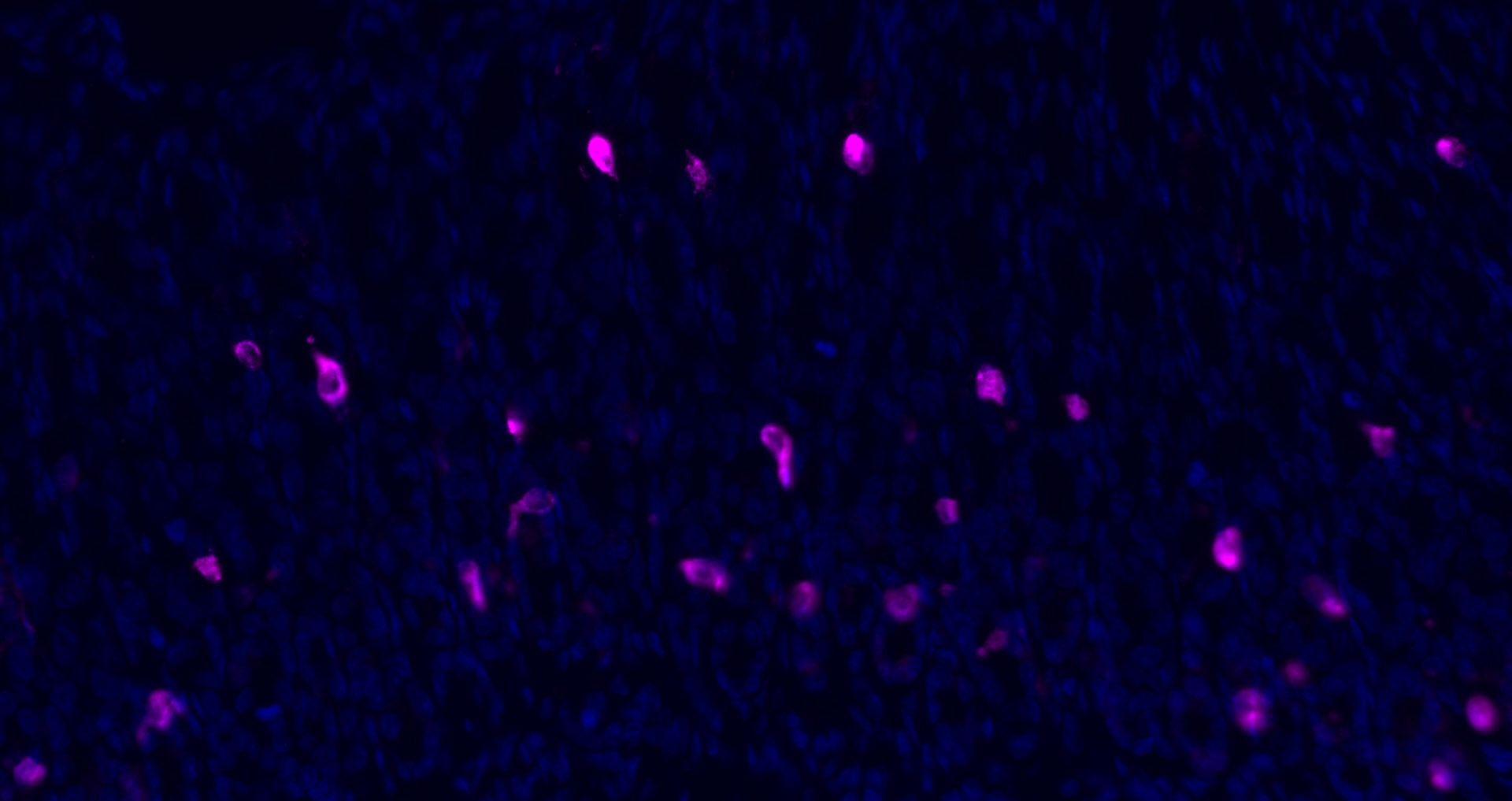 Donkey Anti-Rabbit IgG H&L Secondary Antibody-Cy5