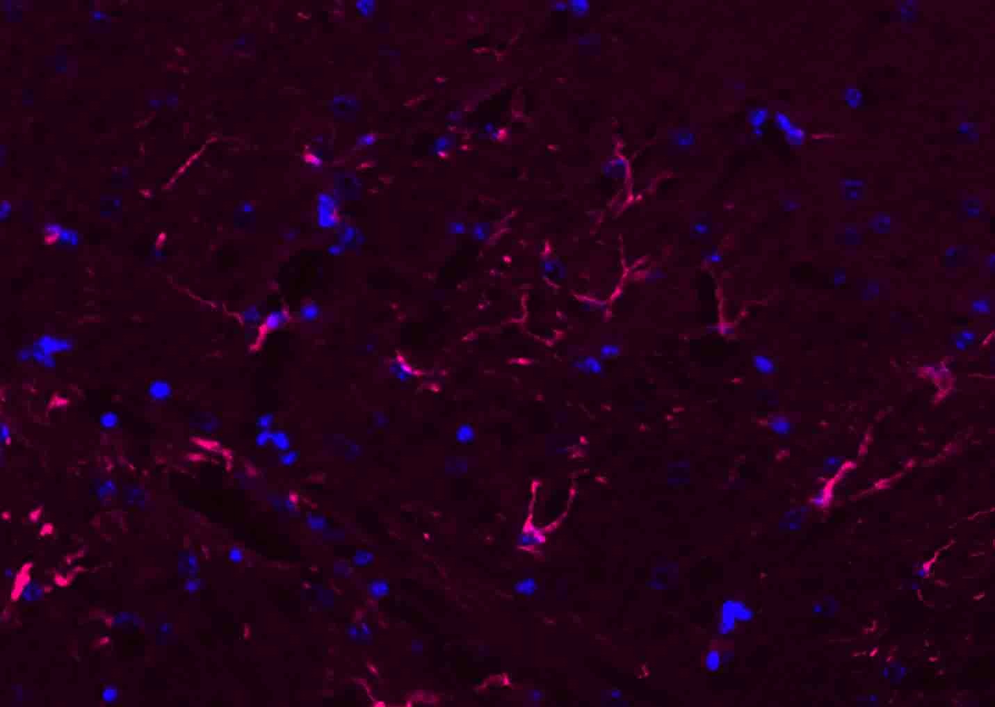 Donkey Anti-Rabbit IgG H&L Secondary Antibody-AF594
