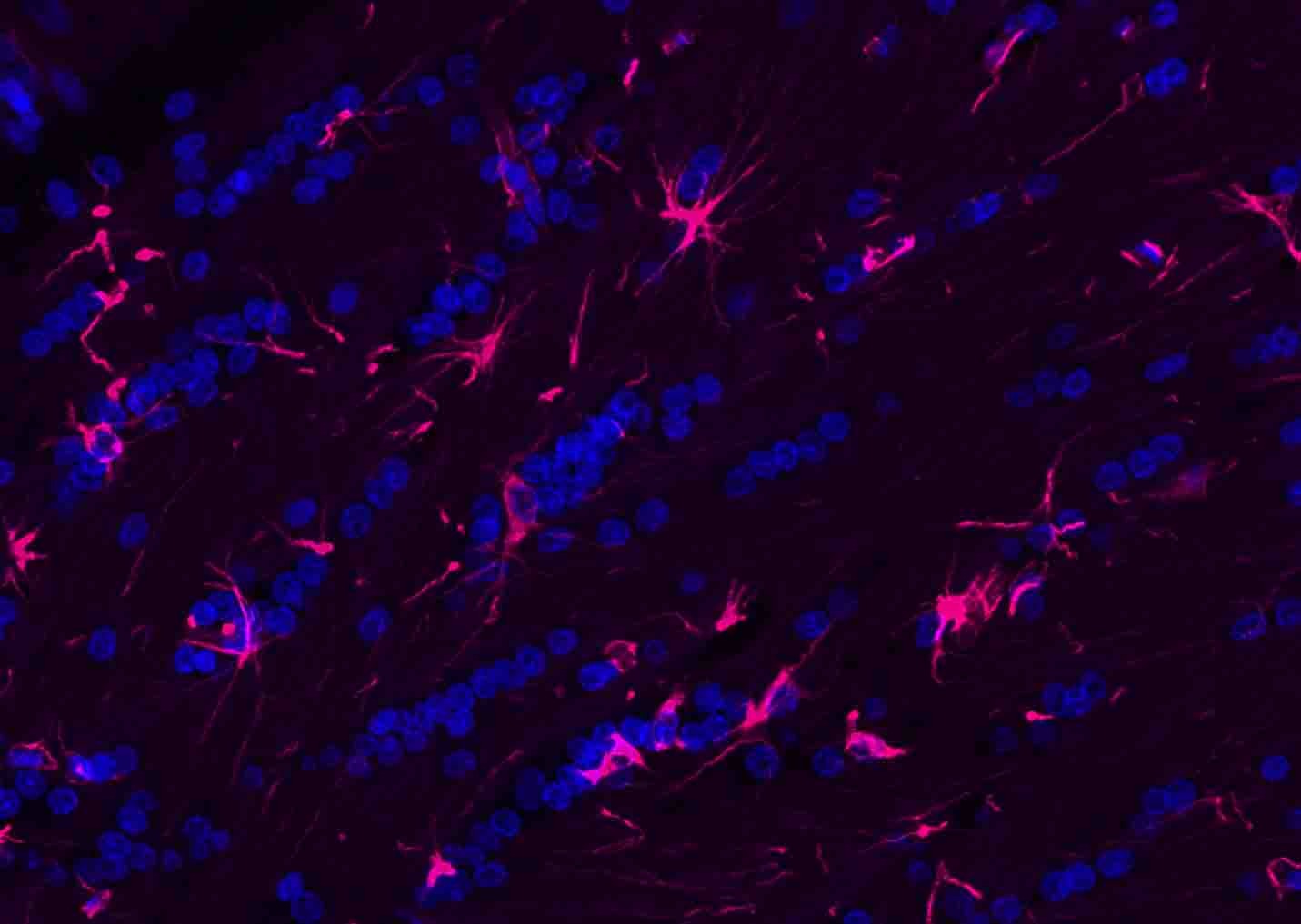 Donkey Anti-Rabbit IgG H&L Secondary Antibody-AF594