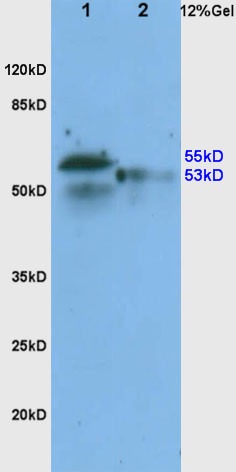 Anti-ADRB1 Polyclonal Antibody
