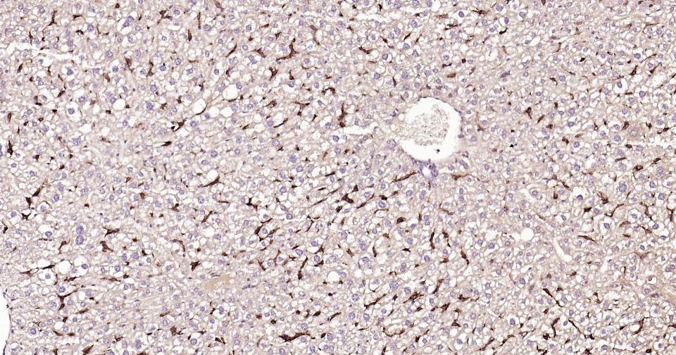 Anti-ADGRE1 Polyclonal Antibody 2