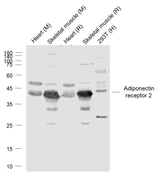 Anti-ADIPOR2 Polyclonal Antibody