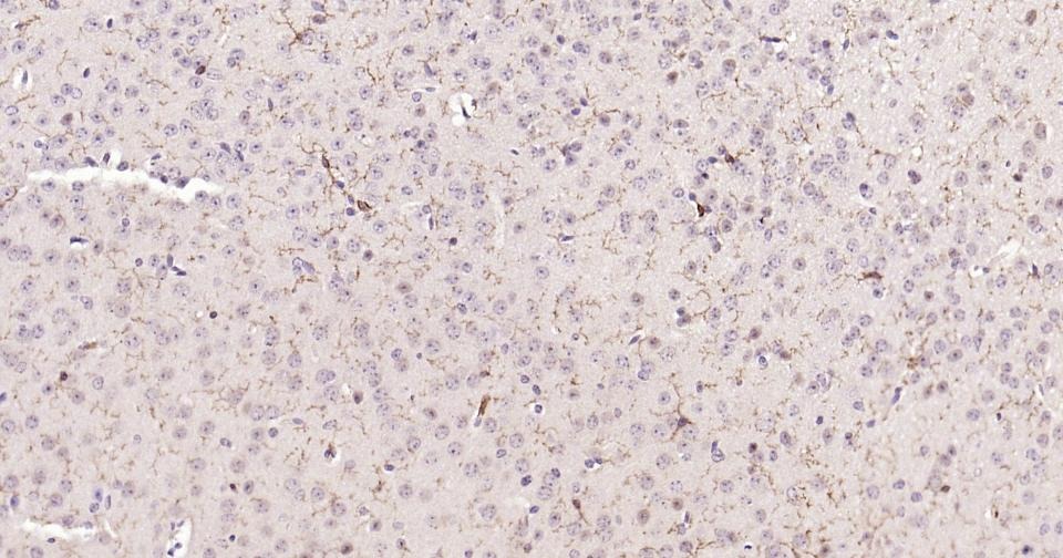 Anti-ADGRE1 Polyclonal Antibody 2