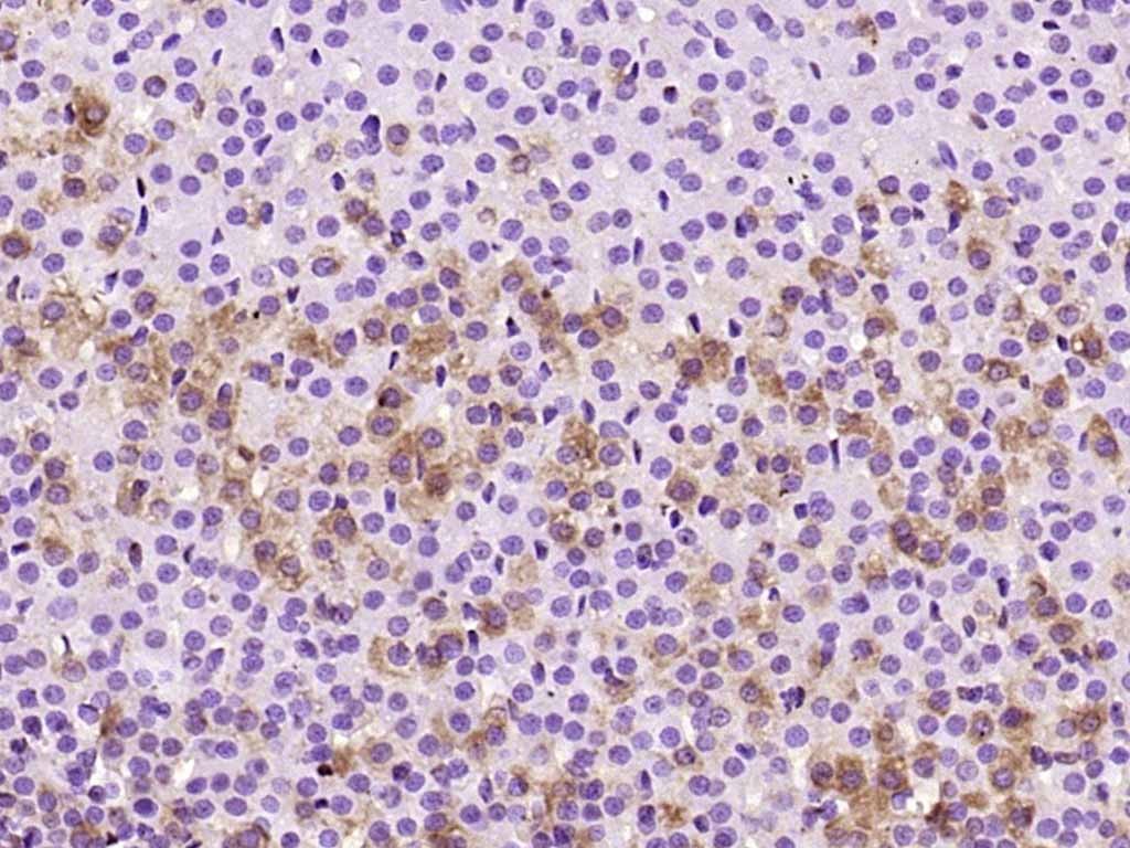 Anti-Adenylate cyclase 1 Polyclonal Antibody