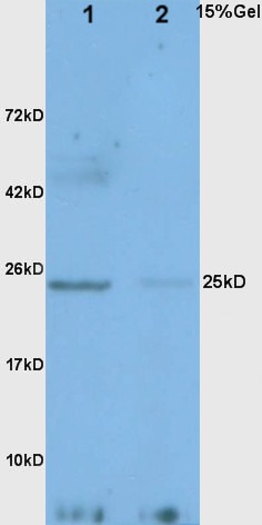 Anti-Adiponectin Polyclonal Antibody