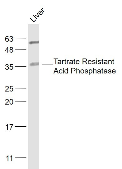 Anti-ACP5 Polyclonal Antibody