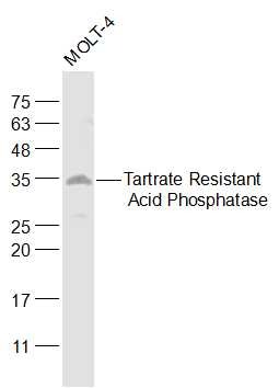 Anti-ACP5 Polyclonal Antibody