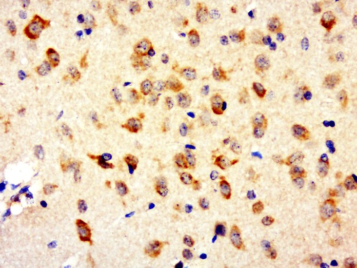 Anti-A3AR Polyclonal Antibody