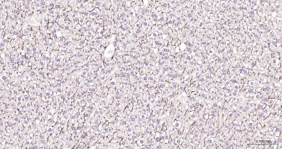 Anti-ABCB1 Polyclonal Antibody