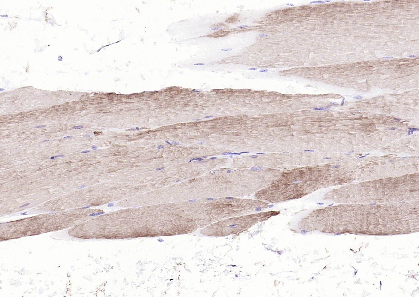 Anti-ACTA1 Polyclonal Antibody