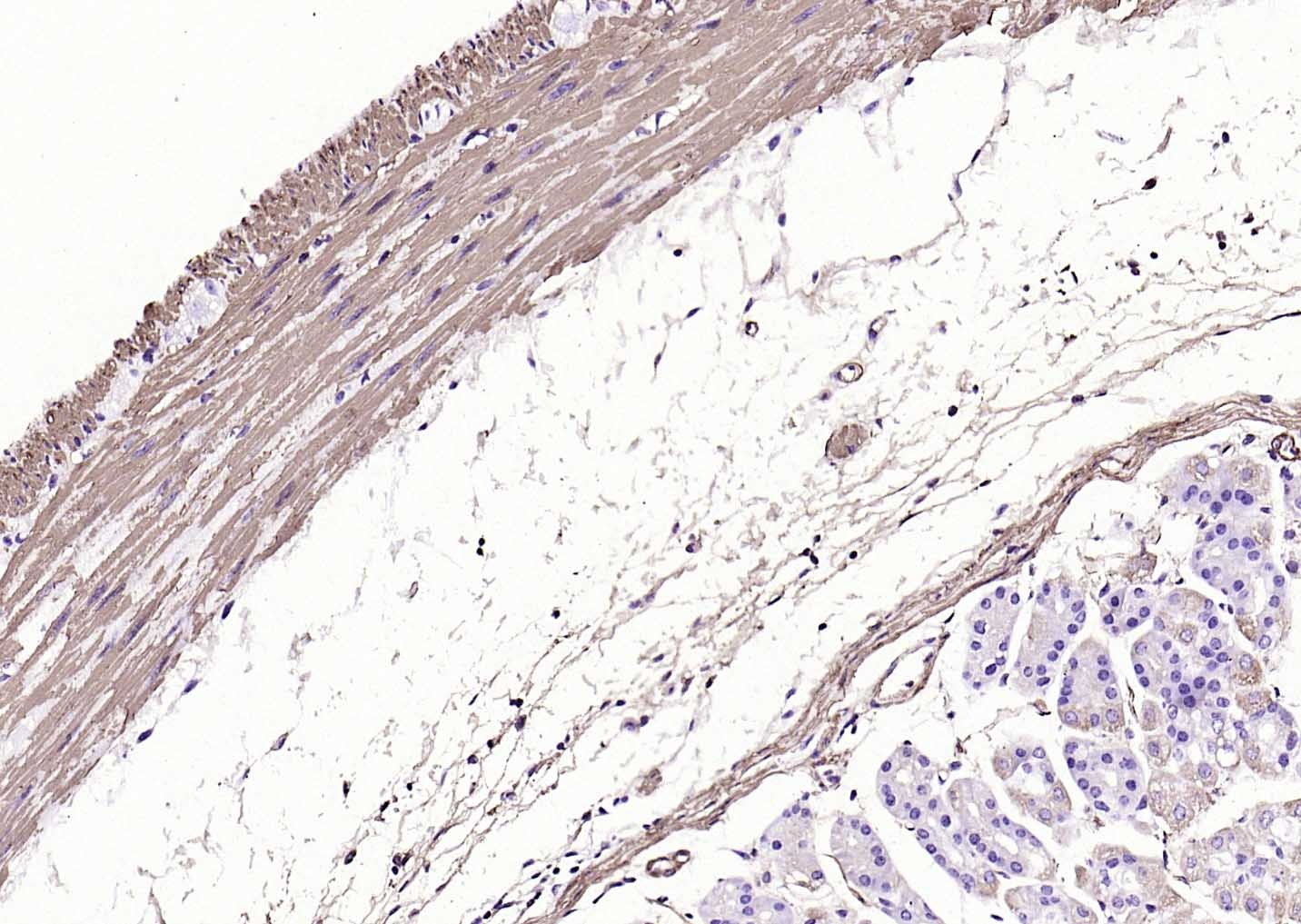 Anti-ACTA2 Antibody (6K554)