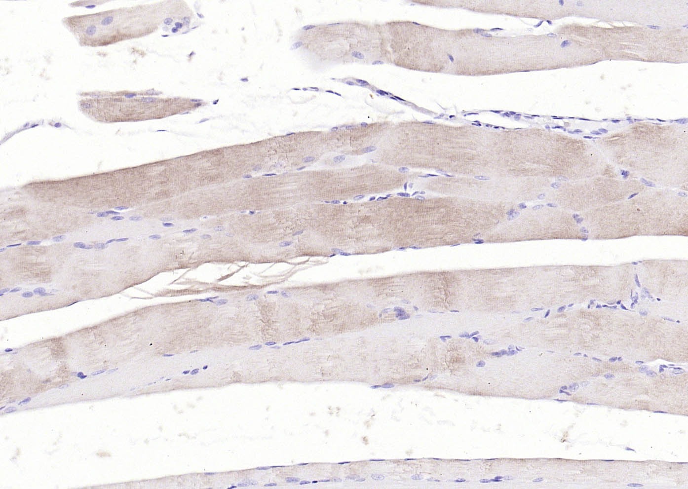 Anti-ACTA1 Polyclonal Antibody