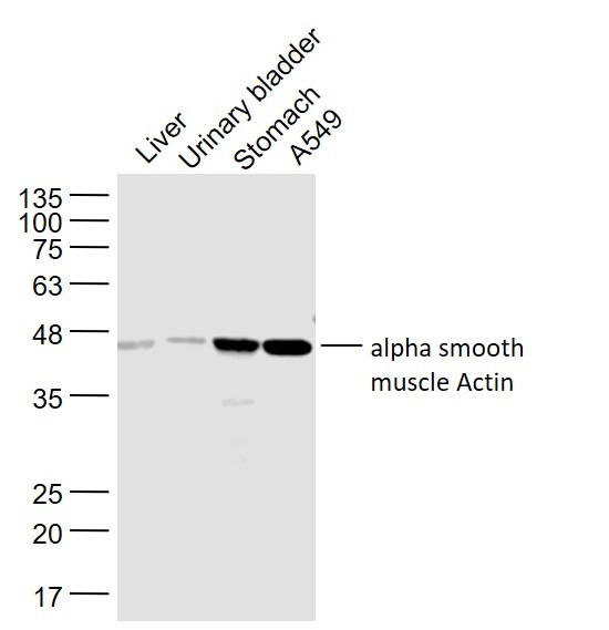 Anti-ACTA2 Polyclonal Antibody