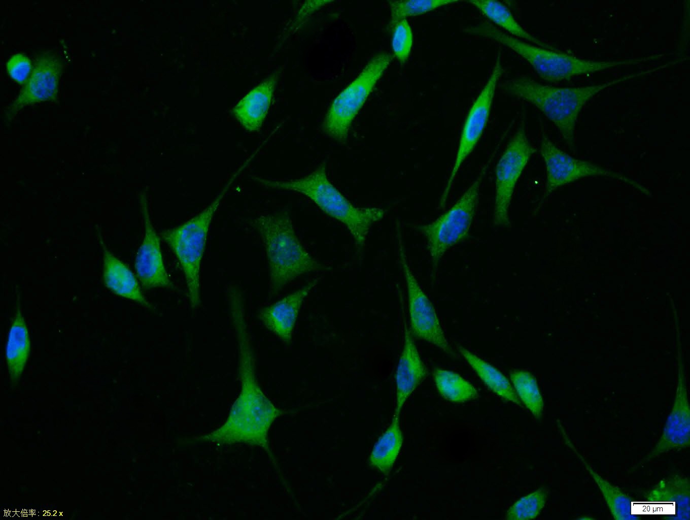 Anti-ABCB1 Polyclonal Antibody 2