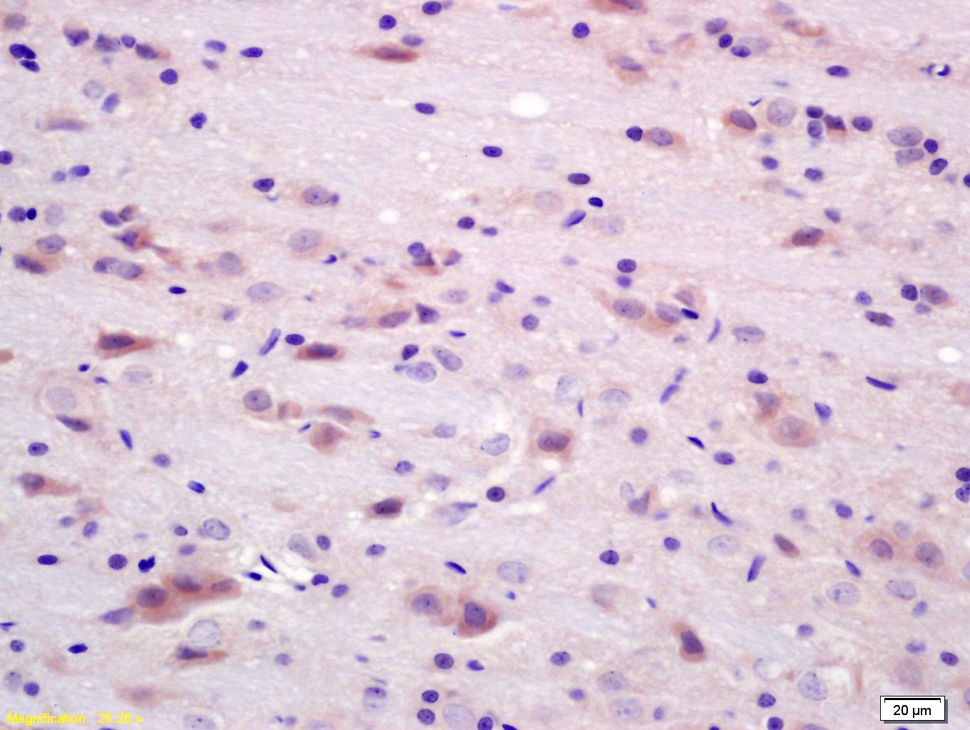 Anti-ABCG2 Polyclonal Antibody