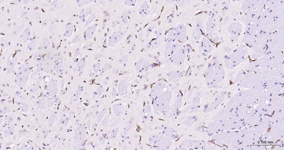Anti-ABCB1 Polyclonal Antibody