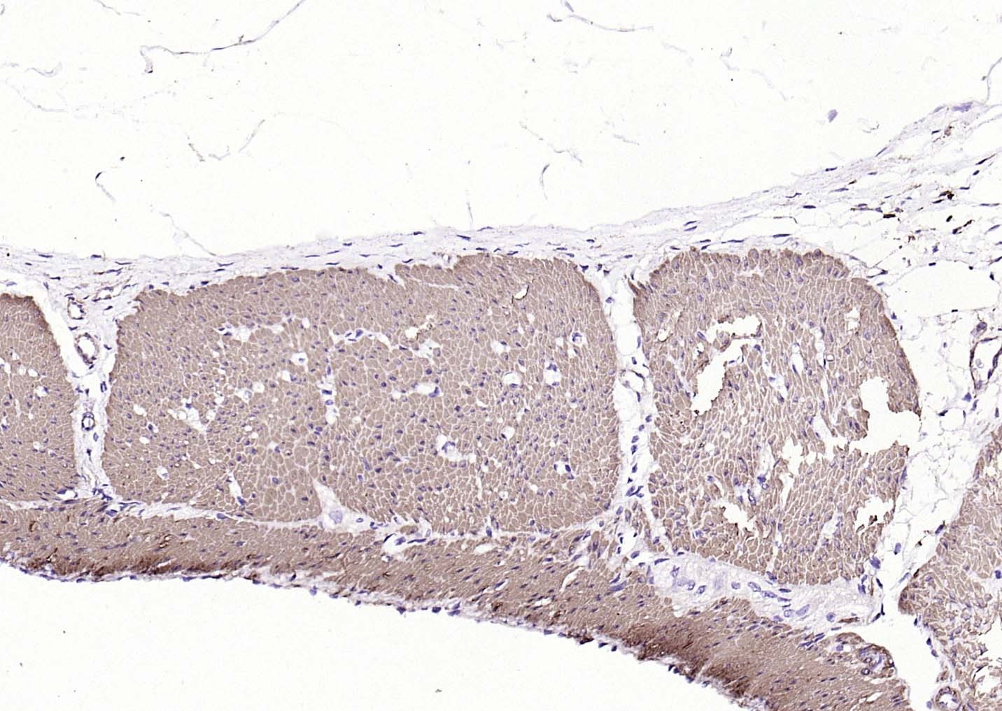 Anti-ACTA2 Antibody (6K554)