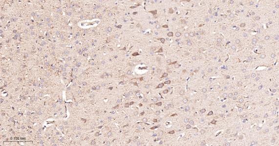 Anti-ACSL4 Antibody (6H118)
