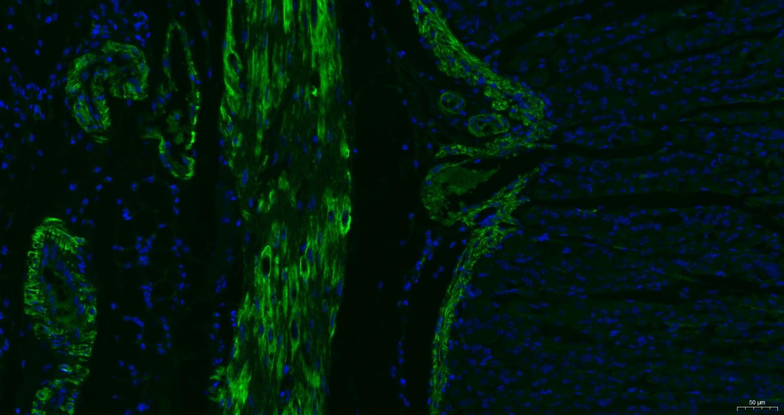 Anti-ACTA2 Antibody (7C949)