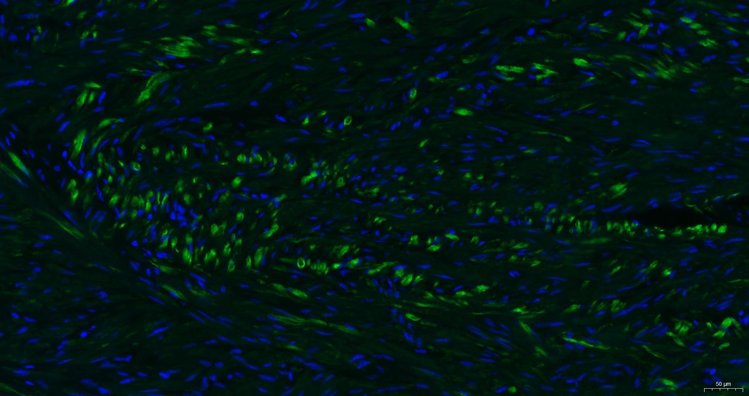 Anti-ACTA2 Antibody (7C949)